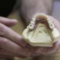 Less Irritation to Gums: How Implant Supported Dentures Offer Convenience and Comfort