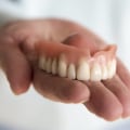 The Truth About Traditional Dentures