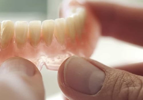Understanding the Cost of Dentures