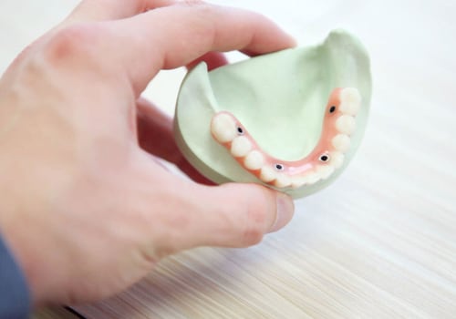The Importance of a Good Fit for Implant Supported Dentures